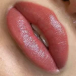 what is lip neutralization